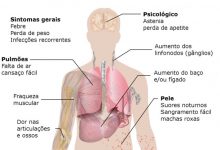 Leucemia