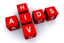 HIV aids