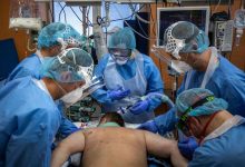 90% dos entubados com covid morrem no Brasil